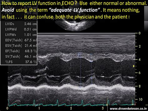 lv scherm|echocardiogram lv dimensions.